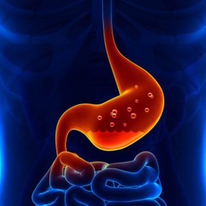 Acid reflux surgery options