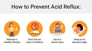 Reflux heartburn remedies stomach remedy naturally acidity away